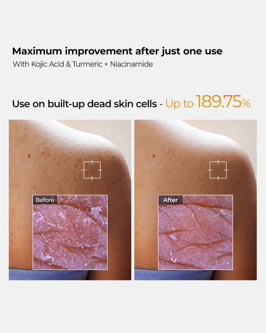 Dr. Melaxin Peel Shot Exfoliating Kojic Acid Turmeric Spray